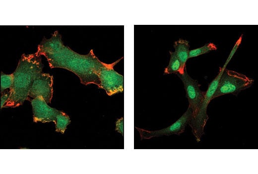 Immunofluorescence Image 1: SMAD3 (C67H9) Rabbit mAb