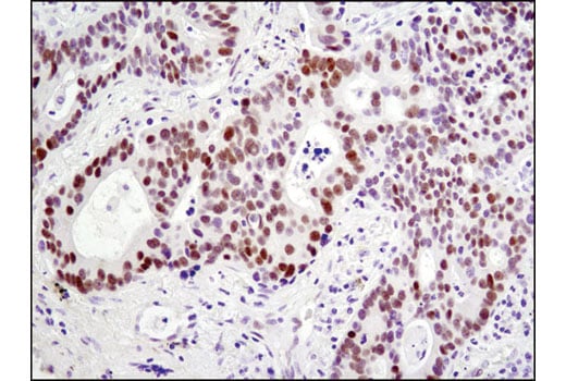 Immunohistochemistry Image 1: HES1 (D6P2U) Rabbit mAb