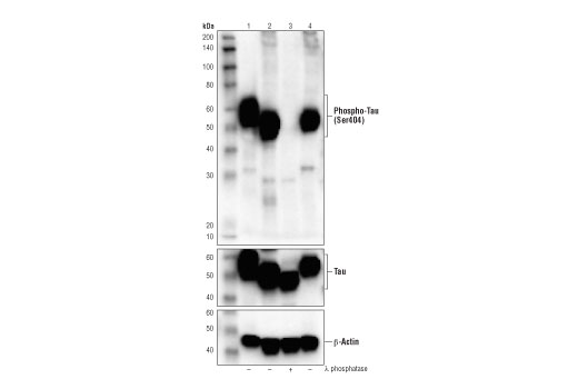 undefined Image 19: LRP1-mediated Endocytosis and Transmission of Tau Antibody Sampler Kit