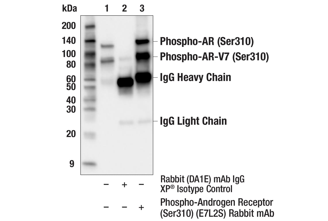 Immunoprecipitation Image 1: Phospho-Androgen Receptor (Ser310) (E7L2S) Rabbit mAb