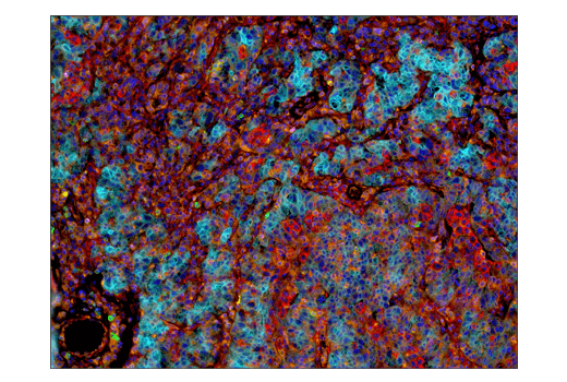Immunohistochemistry Image 5: PD-1 (Intracellular Domain) (D4W2J) XP<sup>®</sup> Rabbit mAb