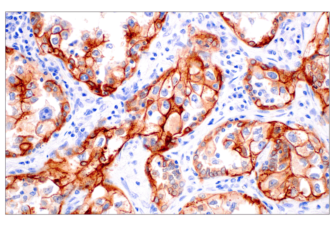 Immunohistochemistry Image 1: Integrin β6 (E4M9P) XP<sup>®</sup> Rabbit mAb