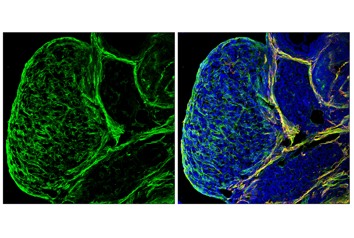 Immunofluorescence Image 1: Caldesmon-1 (D5C8D) XP<sup>®</sup> Rabbit mAb