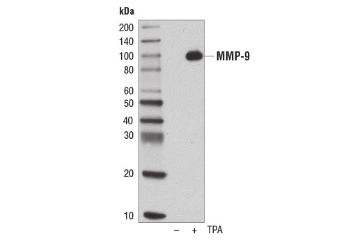 Western Blotting Image 1: MMP-9 (D6O3H) XP<sup>®</sup> Rabbit mAb (BSA and Azide Free)