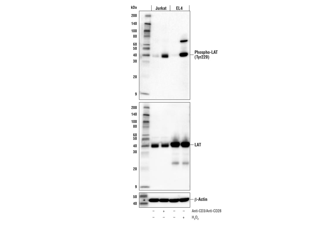 Western Blotting Image 1: Phospho-LAT (Tyr220) (E3S5L) Rabbit mAb