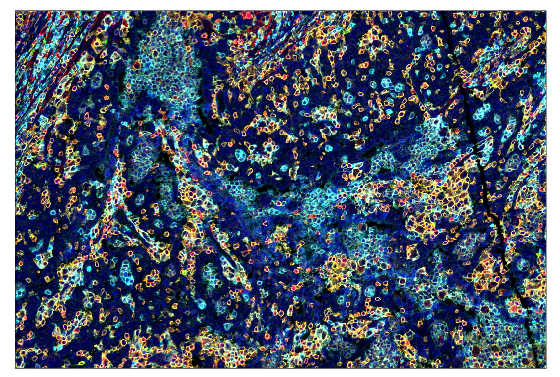 Immunohistochemistry Image 1: CD45 (Intracellular Domain) (D9M8I) & CO-0013-488 SignalStar<sup>™</sup> Oligo-Antibody Pair