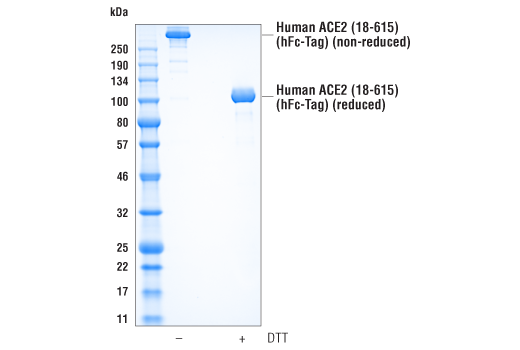Human ACE2 (18-615) Recombinant Protein (hFc-Tag): Image 1