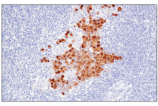 Immunohistochemistry Image 2: MAGE-A4 (E7O1U) XP<sup>®</sup> Rabbit mAb