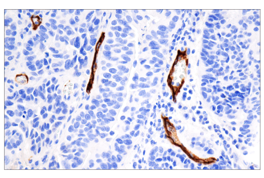 Immunohistochemistry Image 1: CD62P/P-Selectin (E8Q1W) XP<sup>®</sup> Rabbit mAb (BSA and Azide Free)
