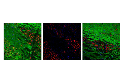 undefined Image 43: LRP1-mediated Endocytosis and Transmission of Tau Antibody Sampler Kit