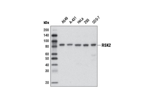 Western Blotting Image 1: RSK2 (D21B2) XP® Rabbit mAb (BSA and Azide Free)