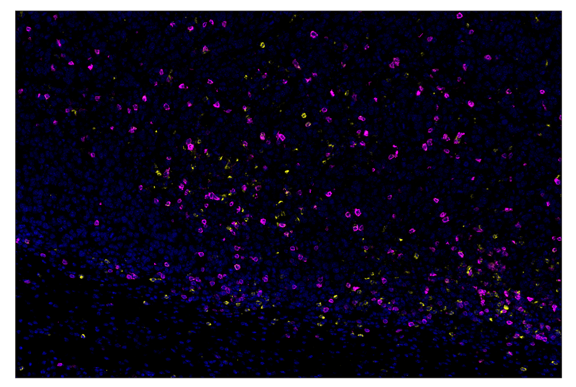 Immunohistochemistry Image 1: CTLA-4 (E2V1Z) & CO-0078-488 SignalStar<sup>™</sup> Oligo-Antibody Pair