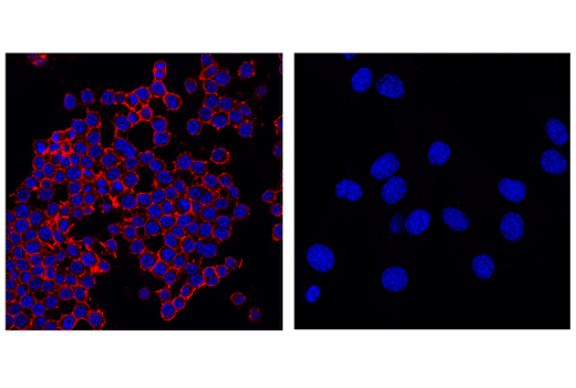 Immunofluorescence Image 1: CD45 (D3F8Q) Rabbit mAb (Alexa Fluor<sup>®</sup> 555 Conjugate)
