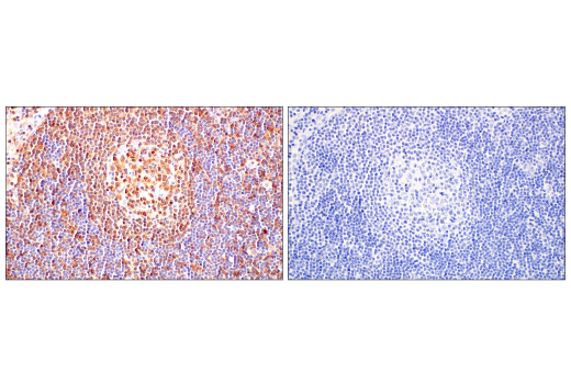 Immunohistochemistry Image 9: c-Rel (E8Z5Y) XP<sup>®</sup> Rabbit mAb (BSA and Azide Free)