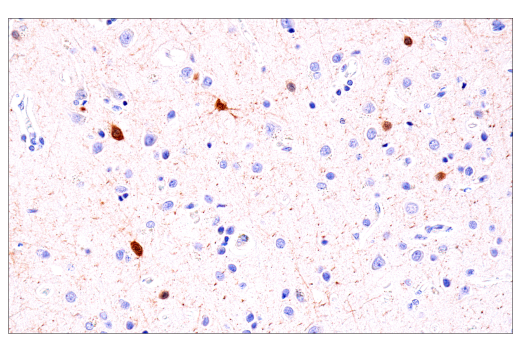Immunohistochemistry Image 1: Parvalbumin (E8N2U) XP<sup>®</sup> Rabbit mAb