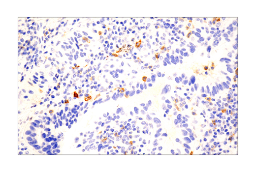 Immunohistochemistry Image 1: TNFRSF8/CD30 (E7E4D) XP<sup>®</sup> Rabbit mAb (BSA and Azide Free)