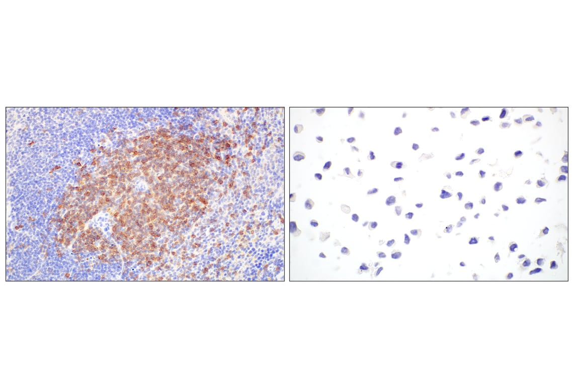 Immunohistochemistry Image 7: CD6 (E9Q1V) Rabbit mAb (BSA and Azide Free)