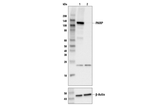 undefined Image 7: Apoptosis Antibody Sampler Kit II