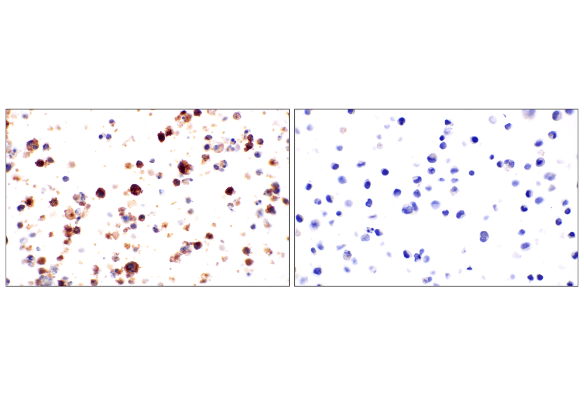 Immunohistochemistry Image 6: CR1/CD35 (E8B1Z) Rabbit mAb