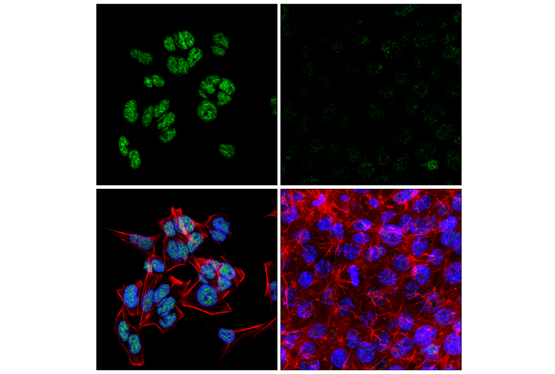 Immunofluorescence Image 1: FoxK1 (E4D1V) Rabbit mAb