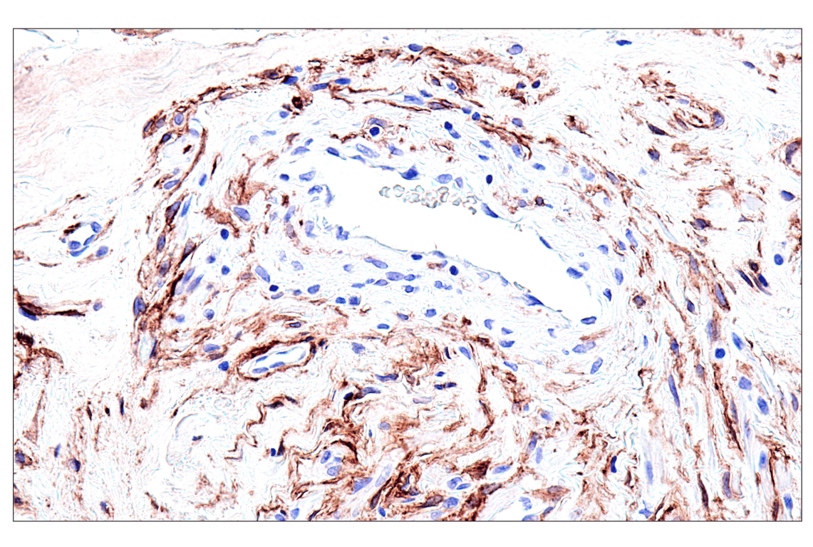 Immunohistochemistry Image 4: FAP (F1A4G) Rabbit mAb