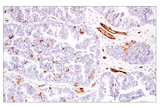 Immunohistochemistry Image 3: CD141/Thrombomodulin (E7Y9P) XP<sup>®</sup> Rabbit mAb (BSA and Azide Free)