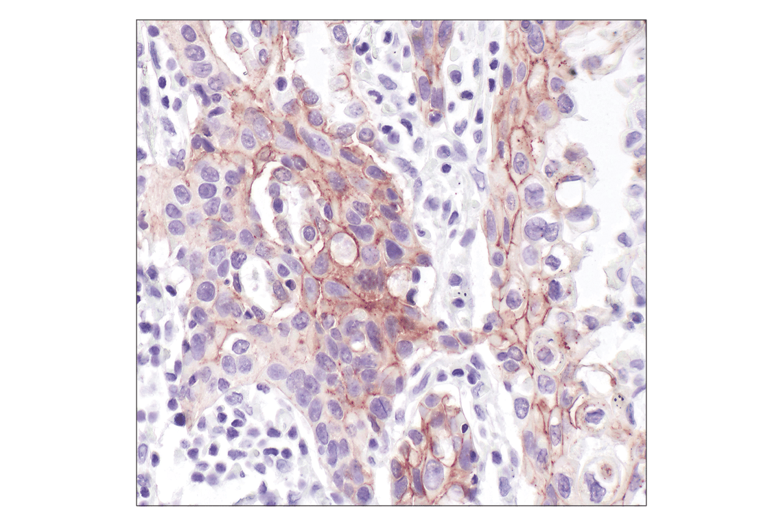 undefined Image 25: Cadherin-Catenin Antibody Sampler Kit