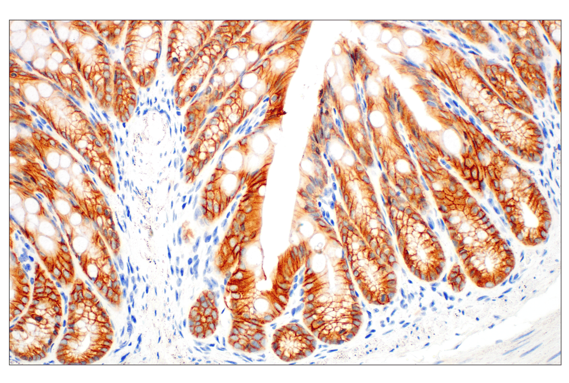 undefined Image 39: Cadherin-Catenin Antibody Sampler Kit