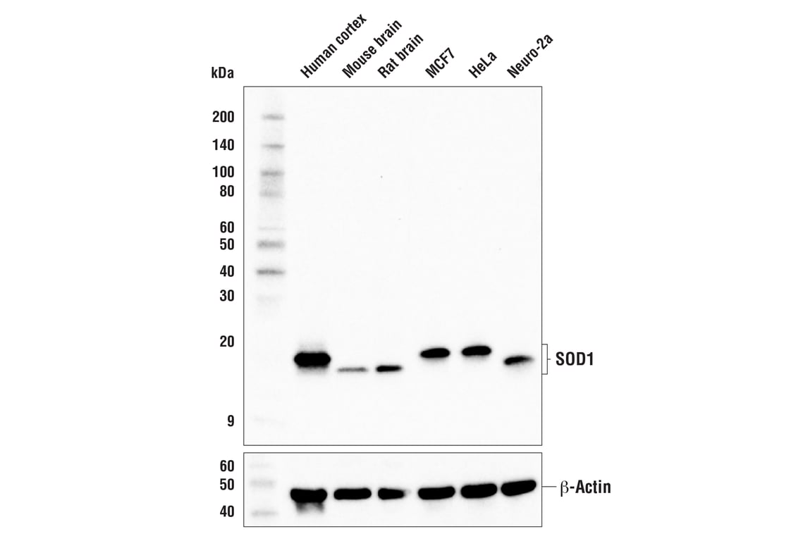 Western Blotting Image 1: SOD1 (E4G1H) XP<sup>®</sup> Rabbit mAb