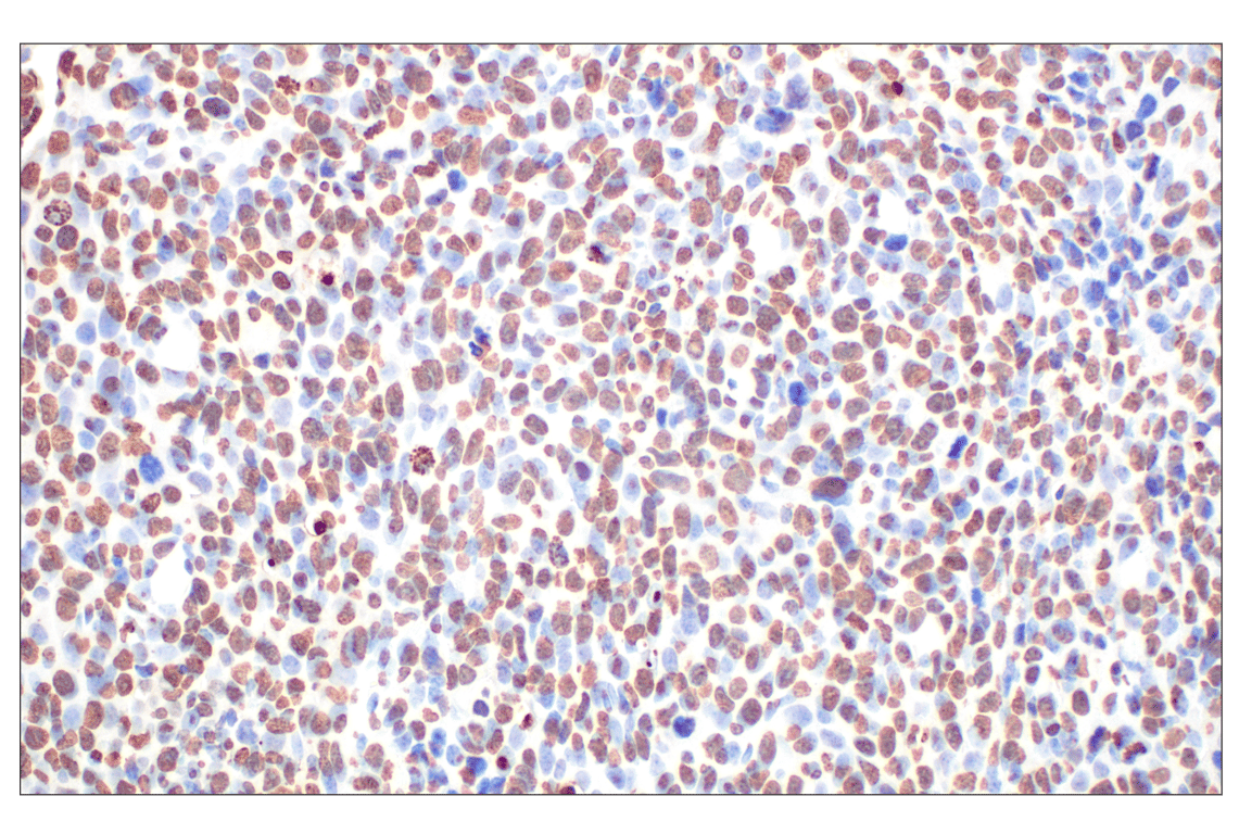 undefined Image 8: PhosphoPlus<sup>®</sup> Histone H3 (Ser10) Antibody Duet