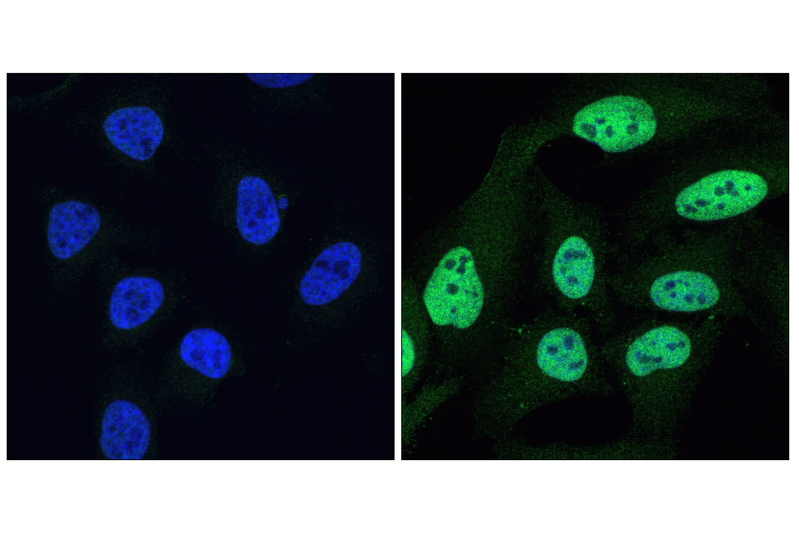 Immunofluorescence Image 1: Phospho-Stat1 (Tyr701) (58D6) Rabbit mAb (BSA and Azide Free)