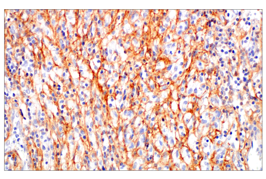 undefined Image 17: Extracellular Matrix Dynamics Antibody Sampler Kit