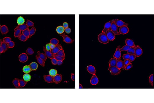 Immunofluorescence Image 1: Phospho-Stathmin (Ser38) (D19H10) Rabbit mAb