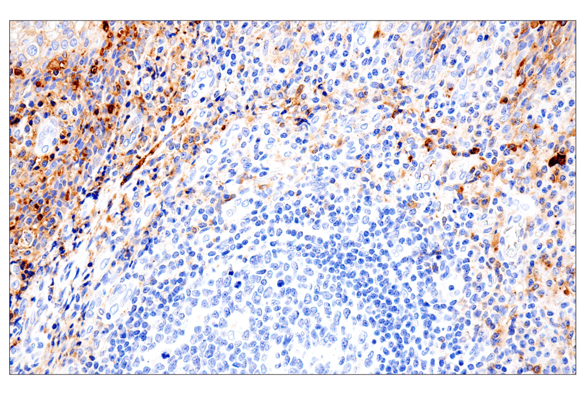 Immunohistochemistry Image 9: Syndecan 1 (E7F7T) Rabbit mAb