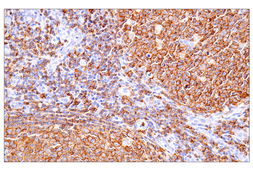Immunohistochemistry Image 3: CD20 (L26) Mouse mAb