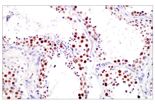 Immunohistochemistry Image 7: DNMT1 (D63A6) XP<sup>®</sup> Rabbit mAb (BSA and Azide Free)