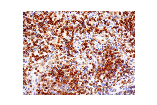Immunohistochemistry Image 2: Bcl-2 (124) Mouse mAb (BSA and Azide Free)