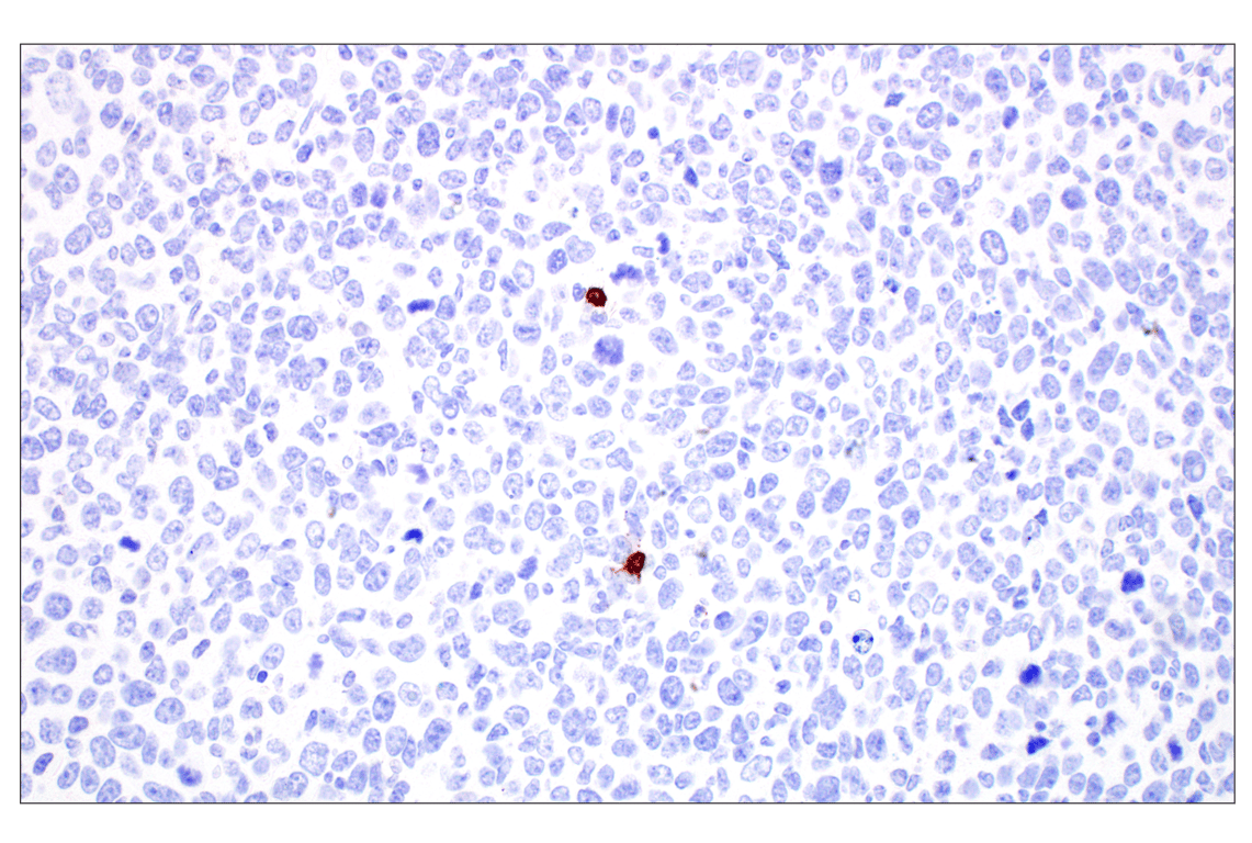 Immunohistochemistry Image 2: CD20 (E3N7O) XP<sup>®</sup> Rabbit mAb