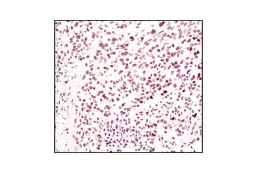 Immunohistochemistry Image 2: Di-Methyl-Histone H3 (Lys4) (C64G9) Rabbit mAb