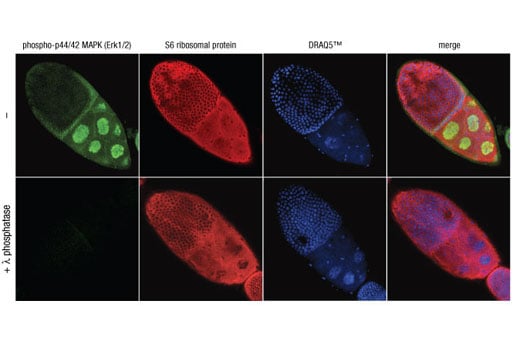 Immunofluorescence Image 1: Phospho-p44/42 MAPK (Erk1/2) (Thr202/Tyr204) (D13.14.4E) XP<sup>®</sup> Rabbit mAb