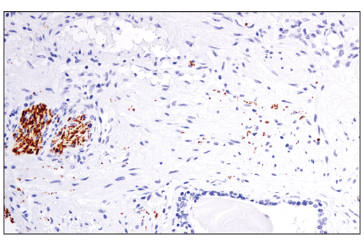 Immunohistochemistry Image 3: Tyrosine Hydroxylase (E2L6M) Rabbit mAb (BSA and Azide Free)