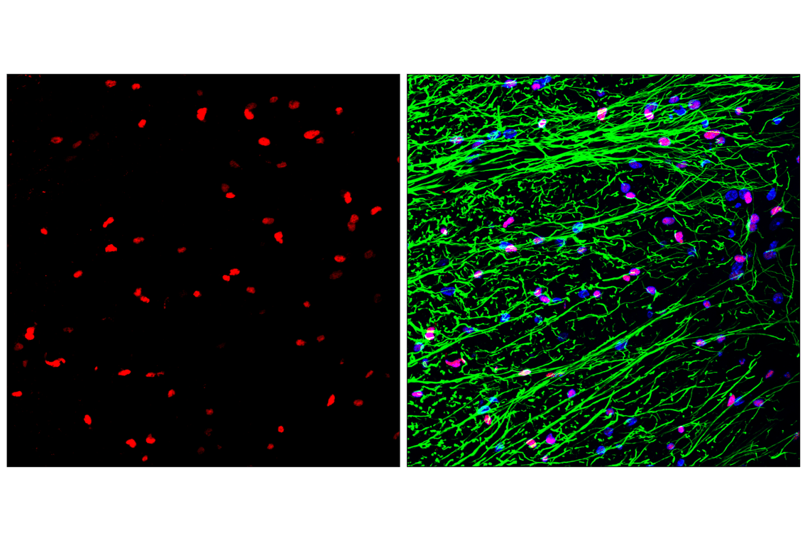 Immunofluorescence Image 2: Olig2 (E6G6Q) XP<sup>®</sup> Rabbit mAb (Alexa Fluor<sup>®</sup> 555 Conjugate)