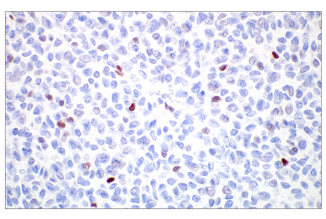 Immunohistochemistry Image 2: GATA-2 (E8B5C) Rabbit mAb (BSA and Azide Free)