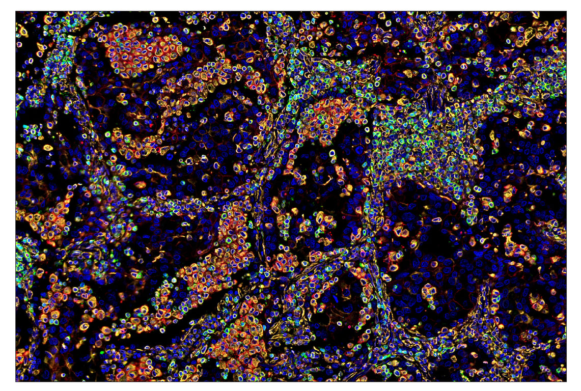 Immunohistochemistry Image 7: TIM-3 (D5D5R<sup>™</sup>) & CO-0010-594 SignalStar<sup>™</sup> Oligo-Antibody Pair