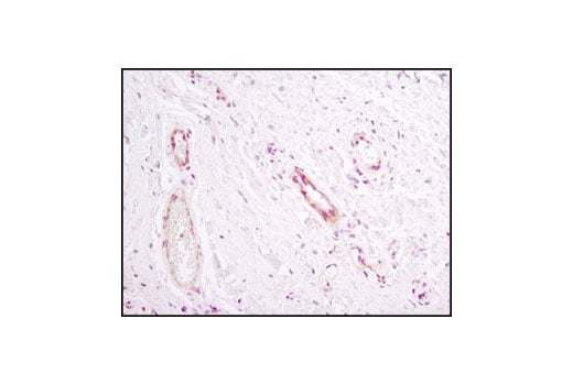 Immunohistochemistry Image 1: Notch1 (D1E11) XP<sup>®</sup> Rabbit mAb