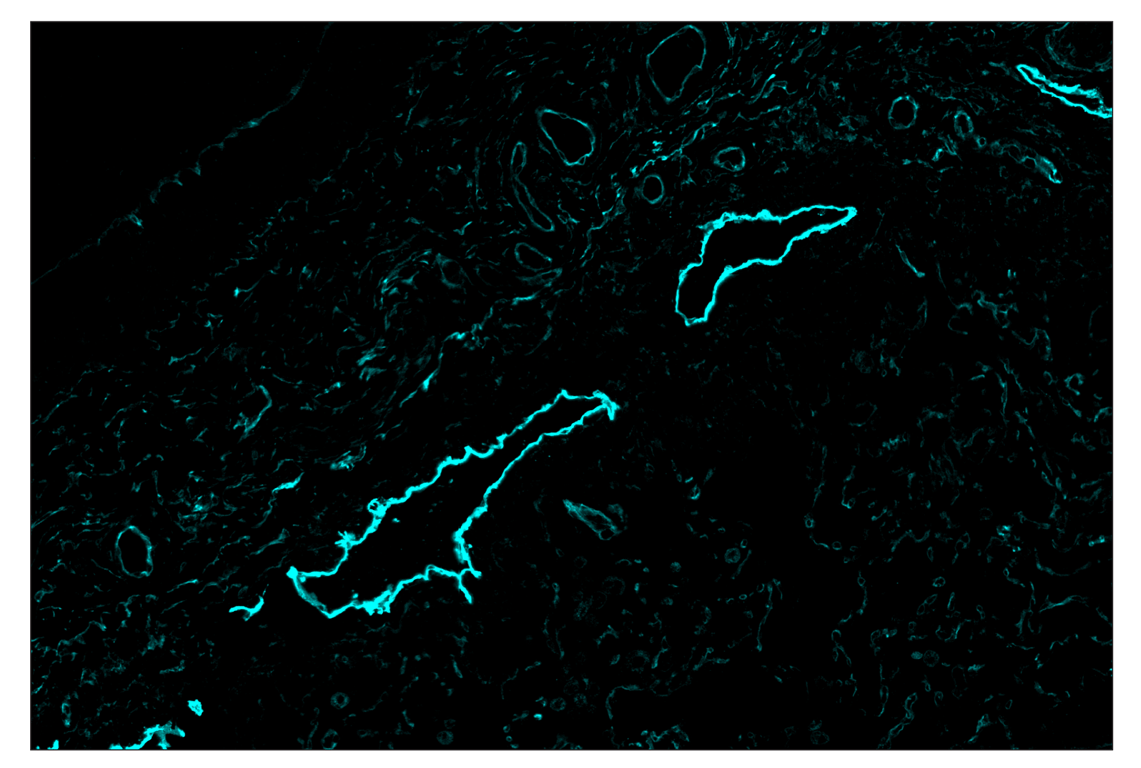 Immunohistochemistry Image 5: NT5E/CD73 (D7F9A) & CO-0039-750 SignalStar<sup>™</sup> Oligo-Antibody Pair
