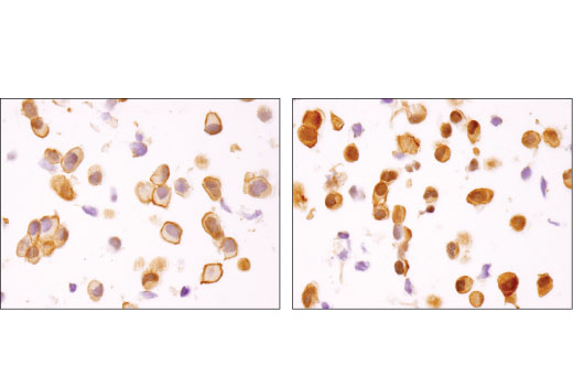 Immunohistochemistry Image 1: Akt1 (D9R8K) Rabbit mAb