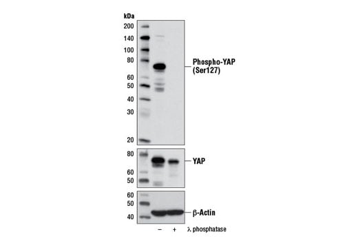 Western Blotting Image 2: Phospho-YAP (Ser127) (D9W2I) Rabbit mAb