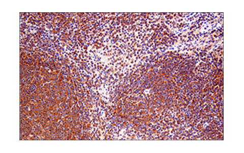 Immunohistochemistry Image 3: RIP (E8S7U) XP<sup>®</sup> Rabbit mAb