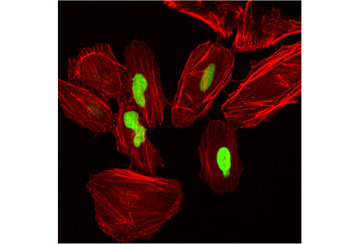 Immunofluorescence Image 1: Cre Recombinase (D7L7L) XP<sup>®</sup> Rabbit mAb (BSA and Azide Free)